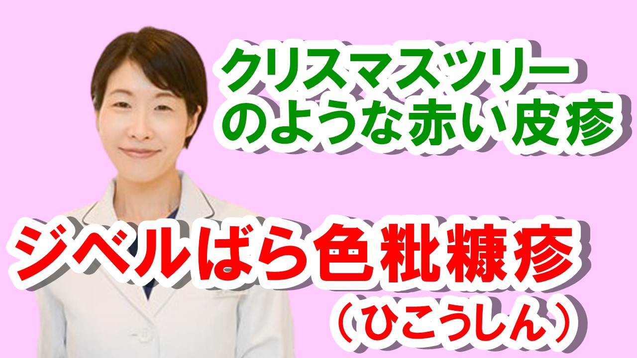 ジベルばら色粃糠疹 (ひこうしん)、クリスマスツリーのような赤い皮疹 希望が丘|やまぐち呼吸器内科・皮膚科クリニック ジベルばら色粃糠疹 (ひこうしん)、クリスマスツリーのような赤い皮疹 希望が丘|やまぐち呼吸器内科・皮膚科クリニック