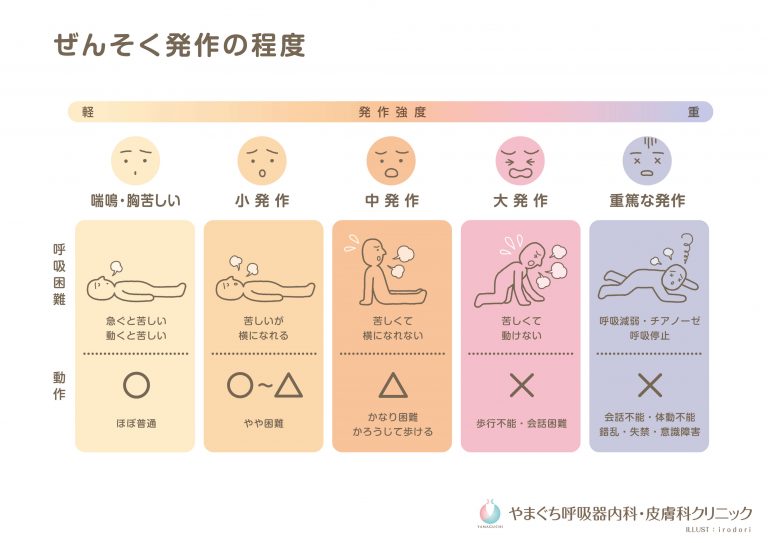 シムビコートの安価な代替品は何ですか?